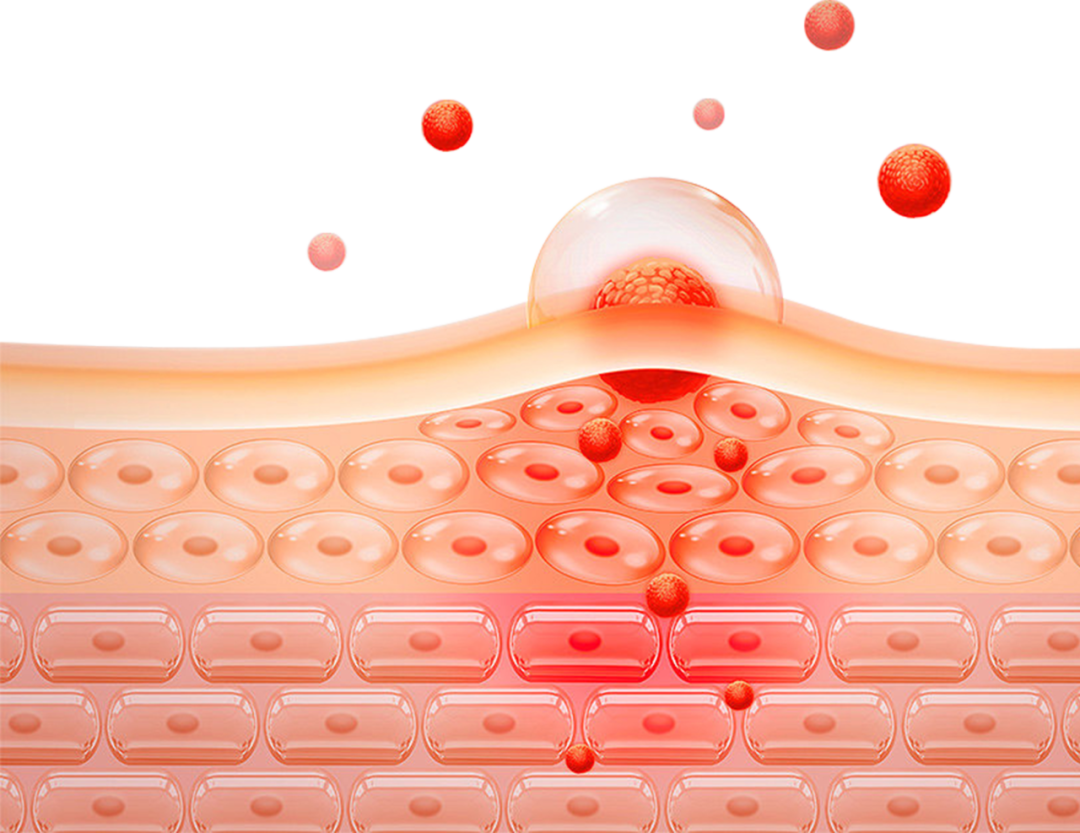 640 (1).png
